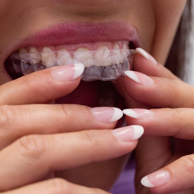 Figsdental Singapore